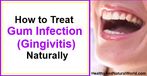 how-to-treat-gum-infection-naturally