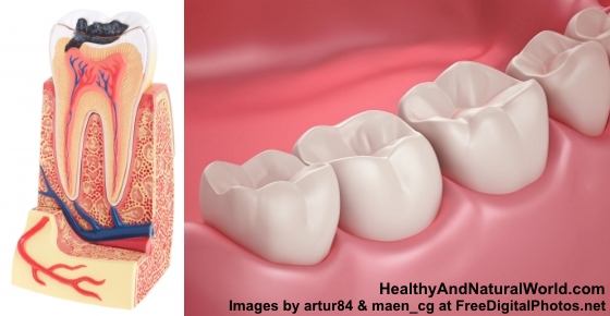 Natural Ways To Treat Gum Infection