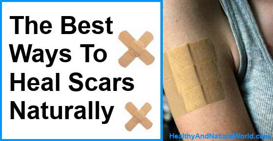 The Best Ways To Heal Scars Naturally