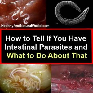 how to get rid of intestinal parasites over the counter