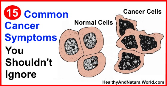 15 Common Cancer Symptoms You Shouldnt Ignore 8142