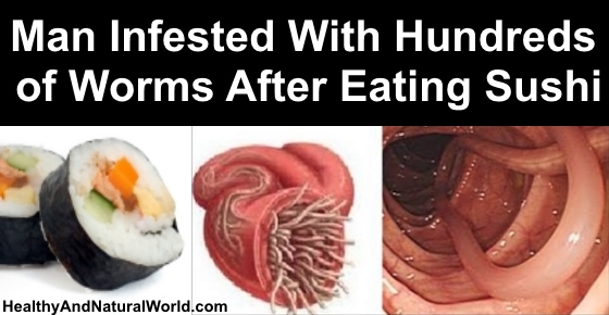 Man Infested With Hundreds Of Worms After Eating Sushi