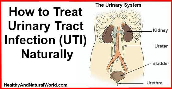 How to Treat Urinary Tract Infection (UTI) Naturally