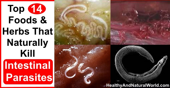 Top 14 Foods and Herbs That Naturally Kill Intestinal Parasites