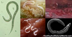 How to Get Rid of Worms in Humans (Including Parasite Cleanse Diet)
