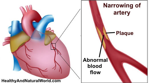 How to Protect and Unblock Your Arteries With Pomegranate