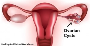 Ovarian Cysts - Warning Signs You Should Not Ignore pregnant woman stomach diagram 