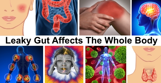heal leaky gut in 2 weeks