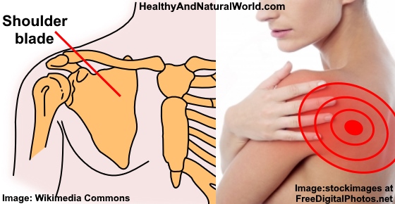 Shoulder Blade Pain Possible Causes And Home Treatments