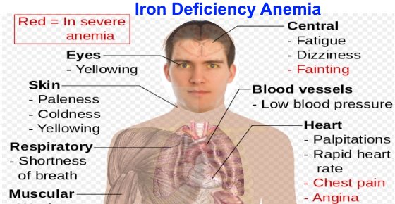 Signs Of Iron Deficiency And How To Increase Iron Levels In Your Blood