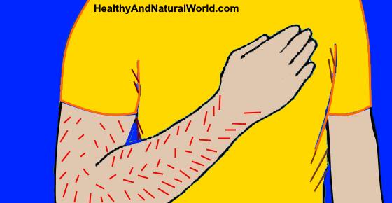 Right Arm Numbness Or Tingling Causes And Home Treatments