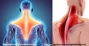 Trapezius Strain: Causes, And Treatments For Trapezius Muscle Pain