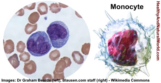 High Or Low Monocytes In Blood Test What Does It Mean 