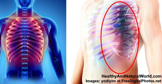 Pain in Left Side Under Ribs: Causes and When You Must see ...