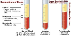 hematocrit hct hemoglobin does healthyandnaturalworld anemia nestia considered polycythemia hematology advertisement