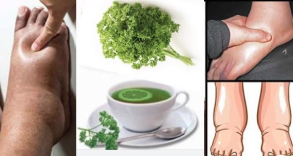 natural-remedies-for-swollen-ankles-legs-feet-parsley-tea-recipe